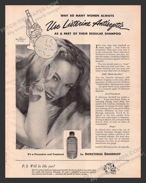 1949 Print Advertisement Listerine to Treat Dandruff Hair Quackery Product Ad.