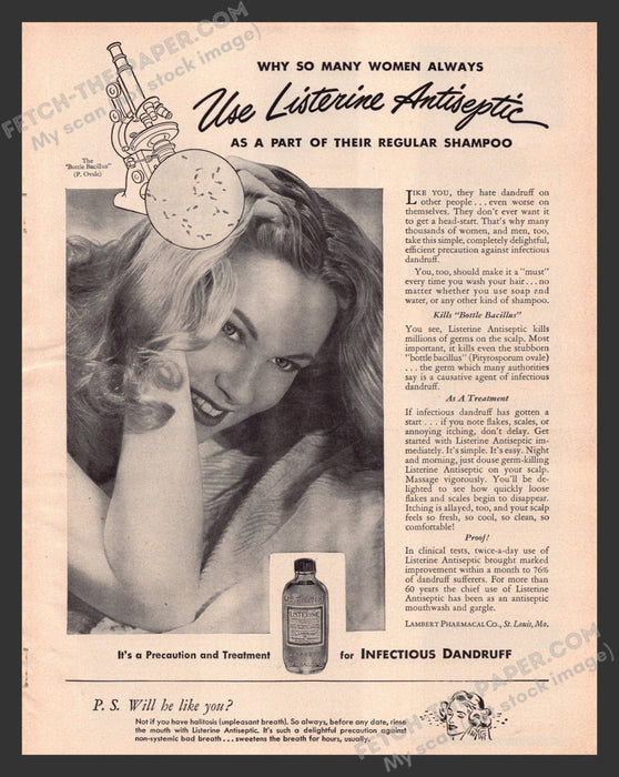 1949 Print Advertisement Listerine to Treat Dandruff Hair Quackery Product Ad.